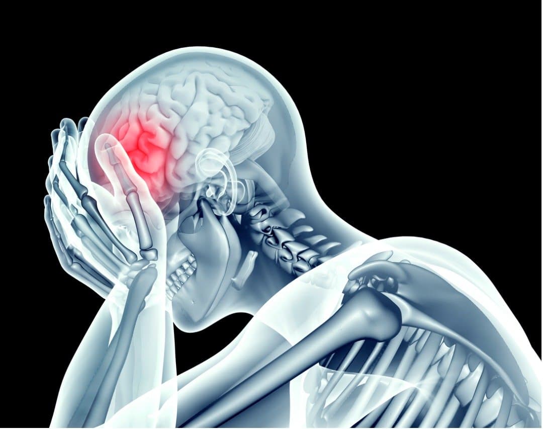 Post-concussion syndrome cranial adjusting - chiropractor San Antonio TX