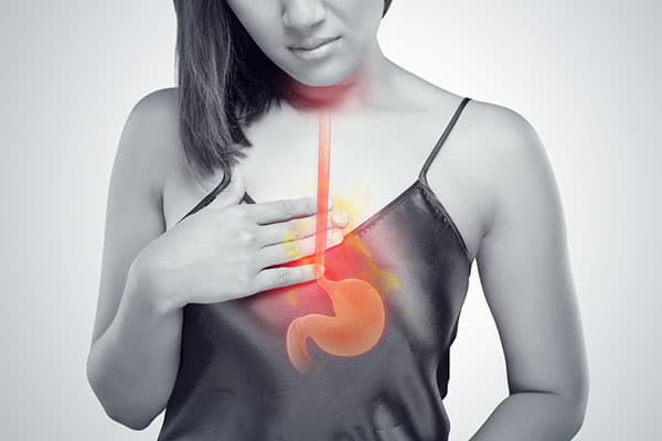 GERD and Acid Reflux: CMRT Treatment | San Antonio TX
